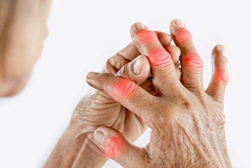 Finger swelling